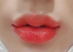 다희잉's Filler review