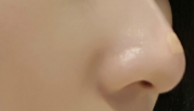 gengnem's Nose Filler review