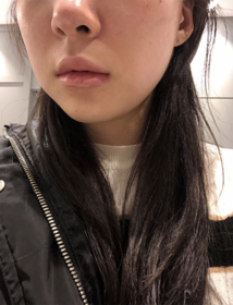 하나하능님의 슈링크 후기
