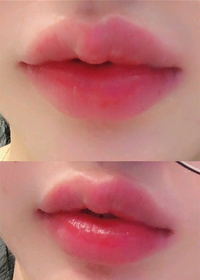 윤윤윤윤윤윤2's Lip Filler review
