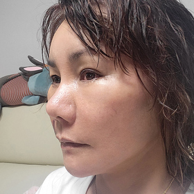 민주띠리's Facelift review