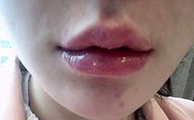얼툥초's Lips review