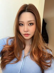 더위사냥걸's Epicanthoplasty, Upper Canthoplasty review