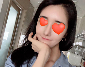 링그리동동님의 에어젯 리프팅 후기