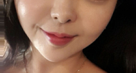 황금빛레야's Filler, Thread Lift review