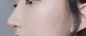 피노끼오's Nose review