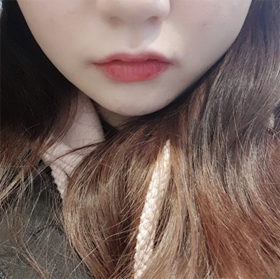 장이야아's Shurink, Botox review