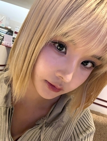 민초단's Incisional Ptosis Correction, Epicanthoplasty, Lateral Canthoplasty, Lower Canthoplasty, Revision review