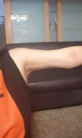 라리오레로's Liposuction review