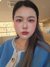 초로기's Non-Incisional Double Eyelid, Lateral Canthoplasty, Lower Canthoplasty review