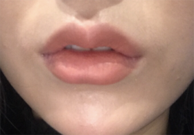 lil887's Lips review
