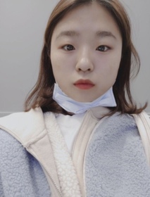 힁홍행's Under-Eye, Botox, Filler review