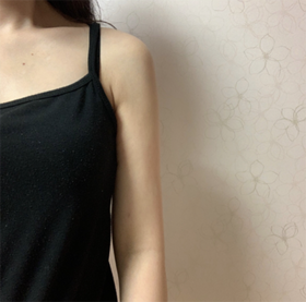 꿀랄릴's Arms, Accessory Breast, Liposuction review