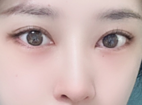 빨강이's Eyes, Nose review