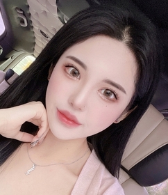 복숭아's Non-Incisional Ptosis Correction (Revision), Upper Canthoplasty, Lower Canthoplasty review