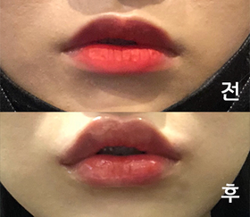임미's Lips review
