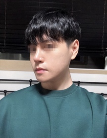 코즈802's Square Jaw, Chin, Nasal Bridge review