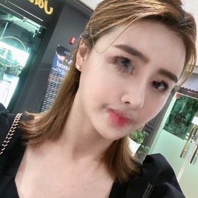 질문받아용's Full-Face Fat Grafting, Nose review