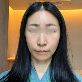 이렇게나좋은's Facelift review
