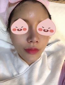 왕꼬부기님의 슈링크 후기