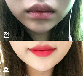 콘크롱이's Lip Filler review