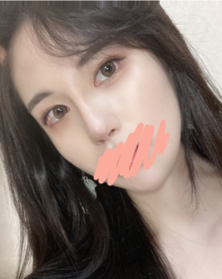 노는게젤좋아's Eyes, Nose, Forehead Lift review