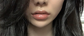 치키이인ㅇㅇ's Filler, Lifting review