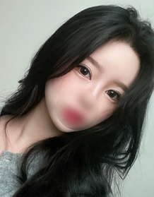 딸기바나나's Incisional Double Eyelid (Revision), Epicanthoplasty review