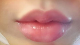 정든2's Lip Filler review