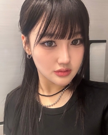 회색바나나's Incisional Double Eyelid, Revision, Epicanthoplasty review