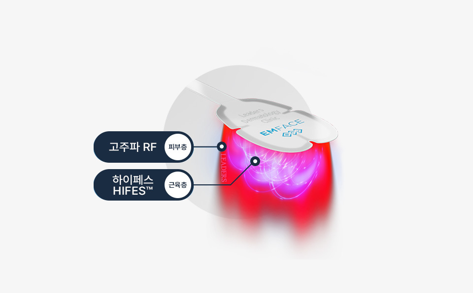 EMFACE RF radiofrequency and HIFES radiofrequency