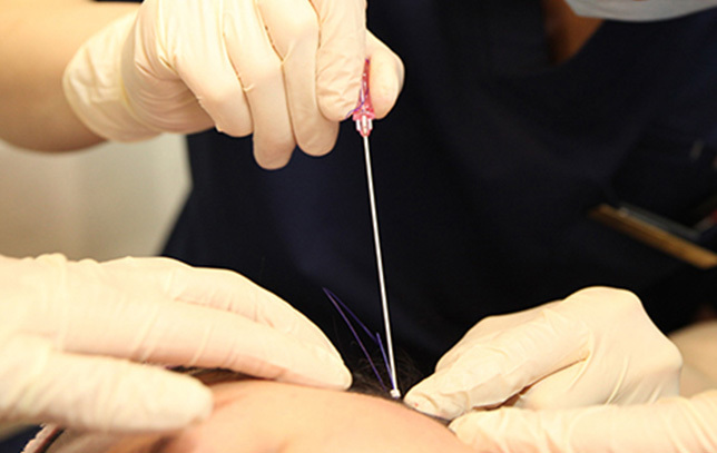Treatment Berdasarkan Pemahaman Struktur Tarikan Benang - gambar detail