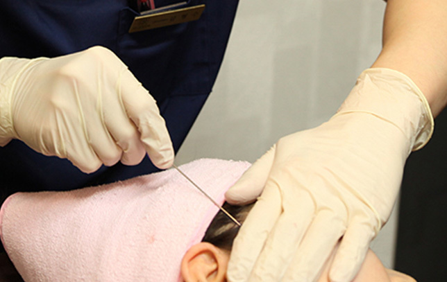 Pemilihan Jenis dan Panjang Benang Sesuai Tingkat Kekenduran dan Area Treatment - gambar detail