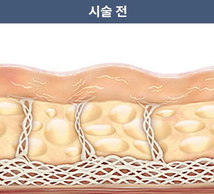 Sebelum Perawatan - gambar detail