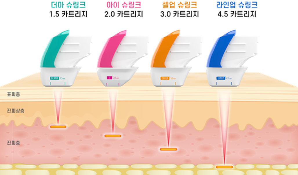 Untuk Lifting, Pilih Kartrid Ultra F