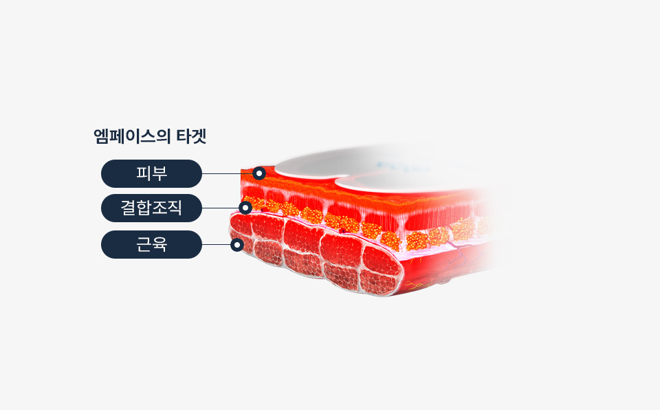 EMFACE memory lifting effect