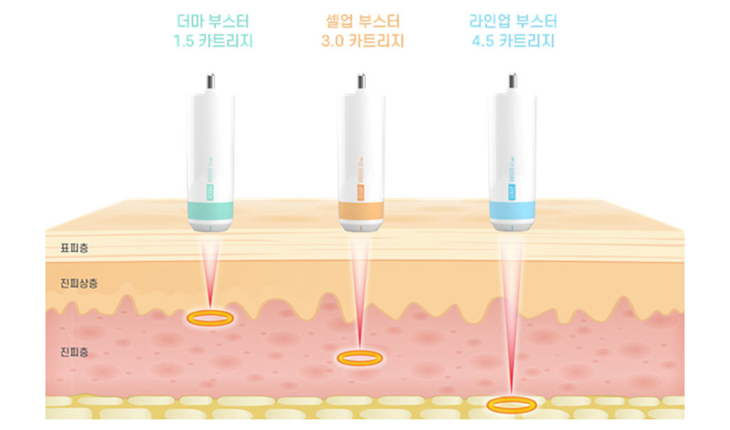 Jika menginginkan lifting yang lebih presisi, pilih kartrid tipe pena Ultra Booster Handpiece.