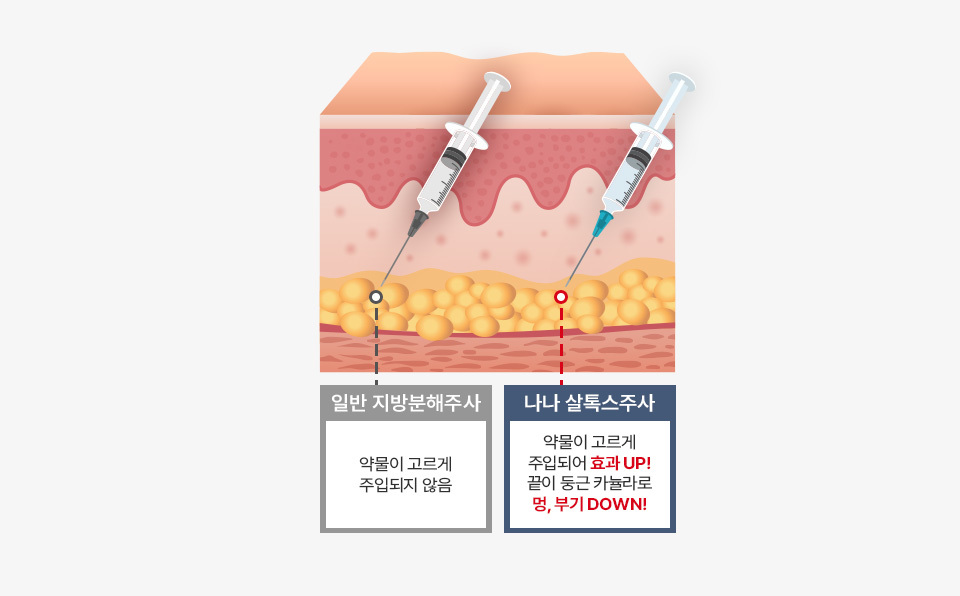 Metode Fat-Dissolving Khusus NANA - gambar detail