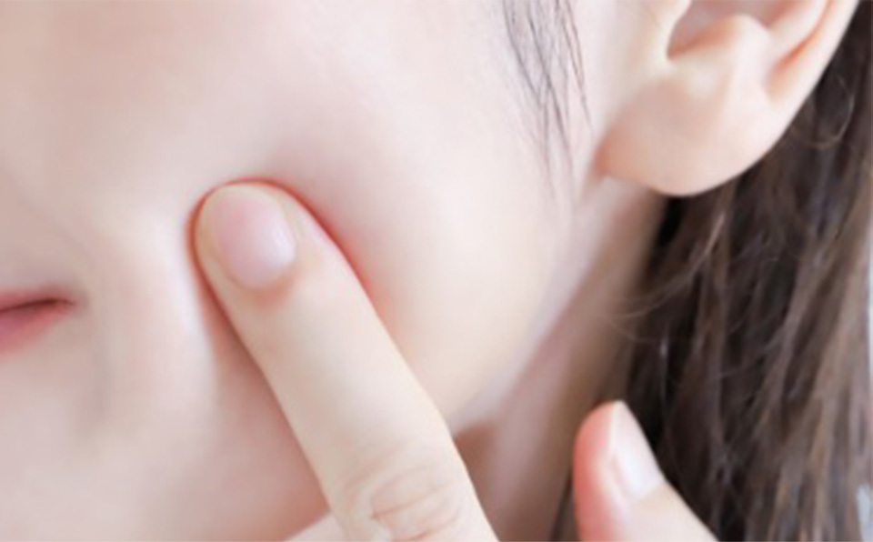 Pigmentation and Scar Improvement - detail image