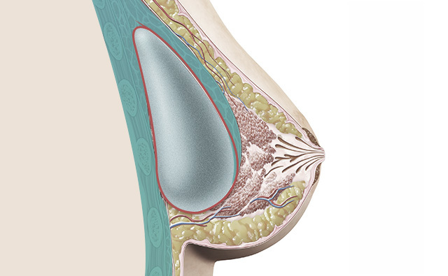 Di Bawah Seluruh Otot - gambar detail