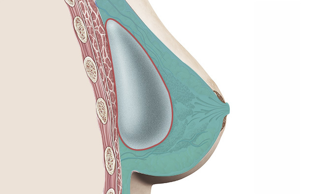 Di Bawah Jaringan Kelenjar Payudara / Fascia - gambar detail