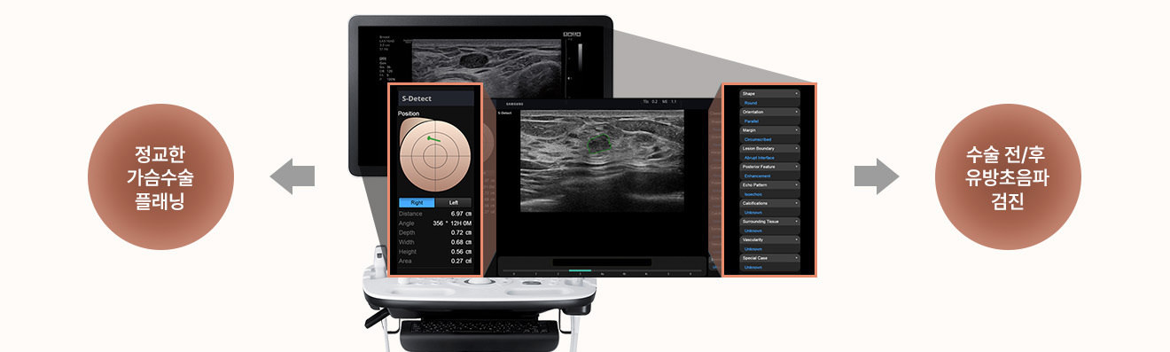 Collaboration between plastic surgeons and breast disease specialists - detail image
