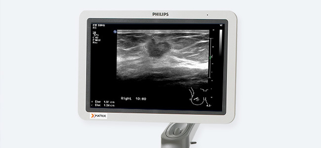 Diagnosis Akurat melalui USG - gambar detail