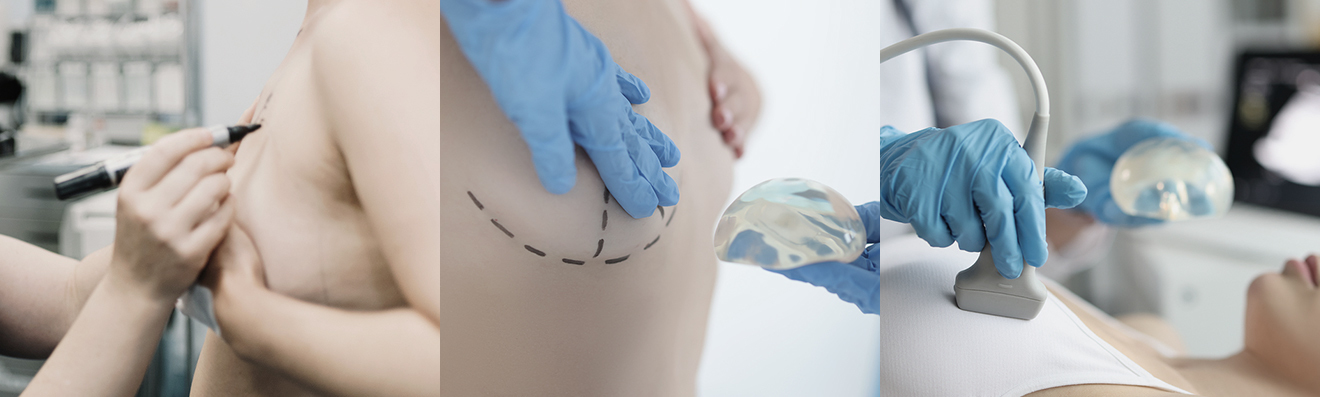 Mengapa Memilih Klinik Bedah Plastik yang Memiliki Breast Clinic? - gambar prosedur