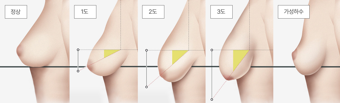 Medical RECOMMEND - gambar prosedur