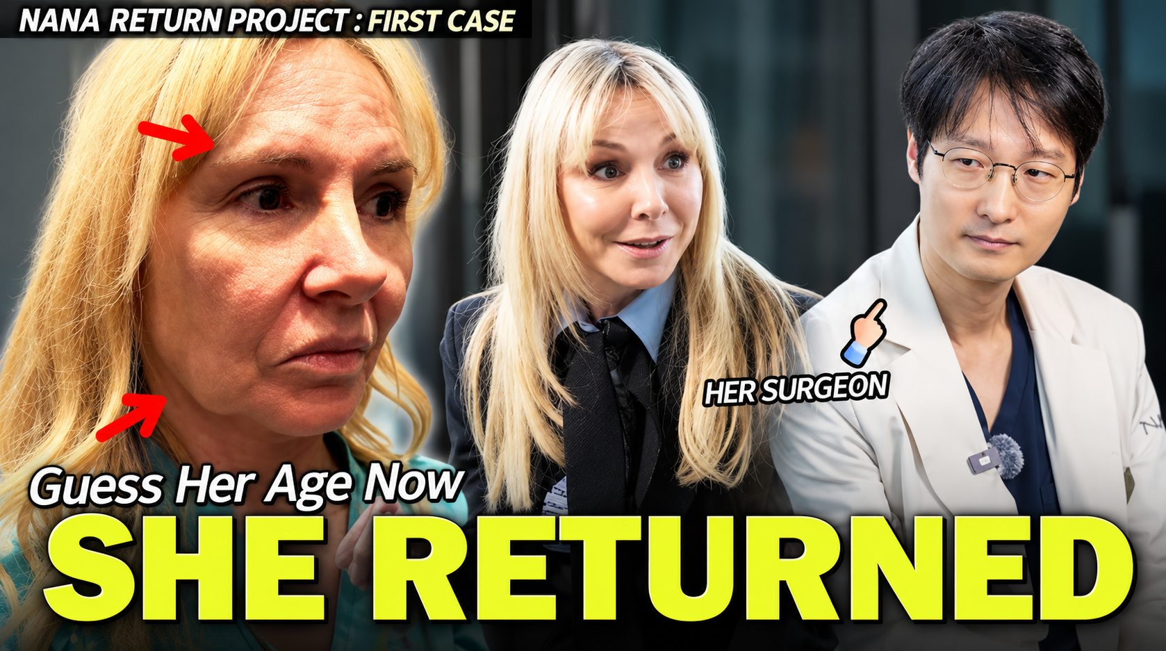 I Lost 20 Years in Korea! The Ultimate Face Lift Transformation Story