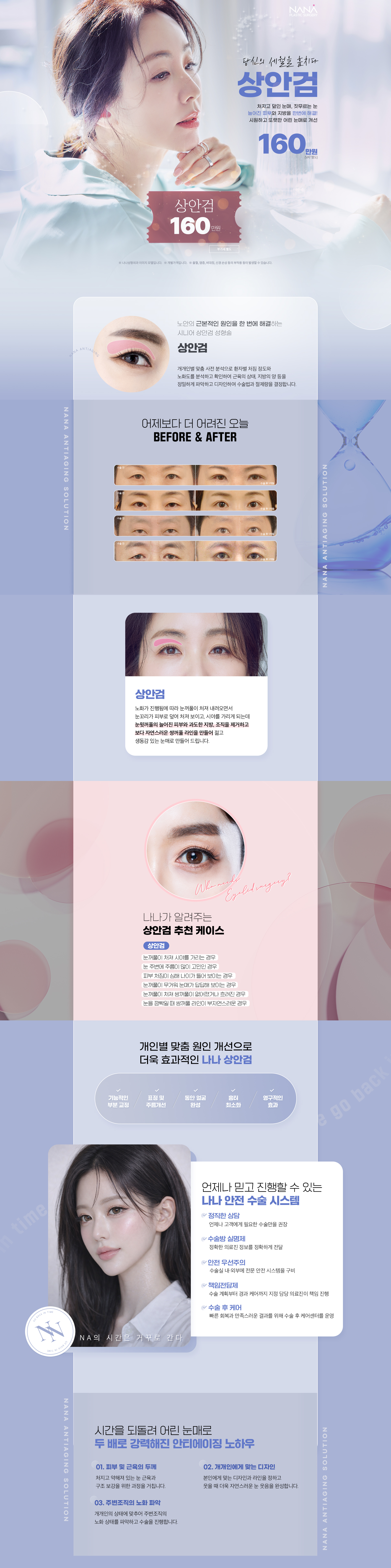상안검수술 1