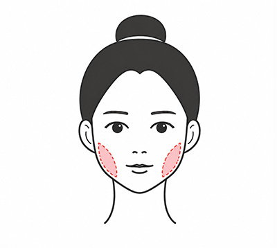 필요 시 교근 심부볼 개선