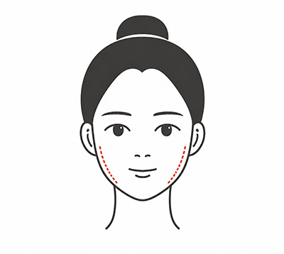 턱 끝까지 부드럽게 이어지는 긴곡선 절골 진행