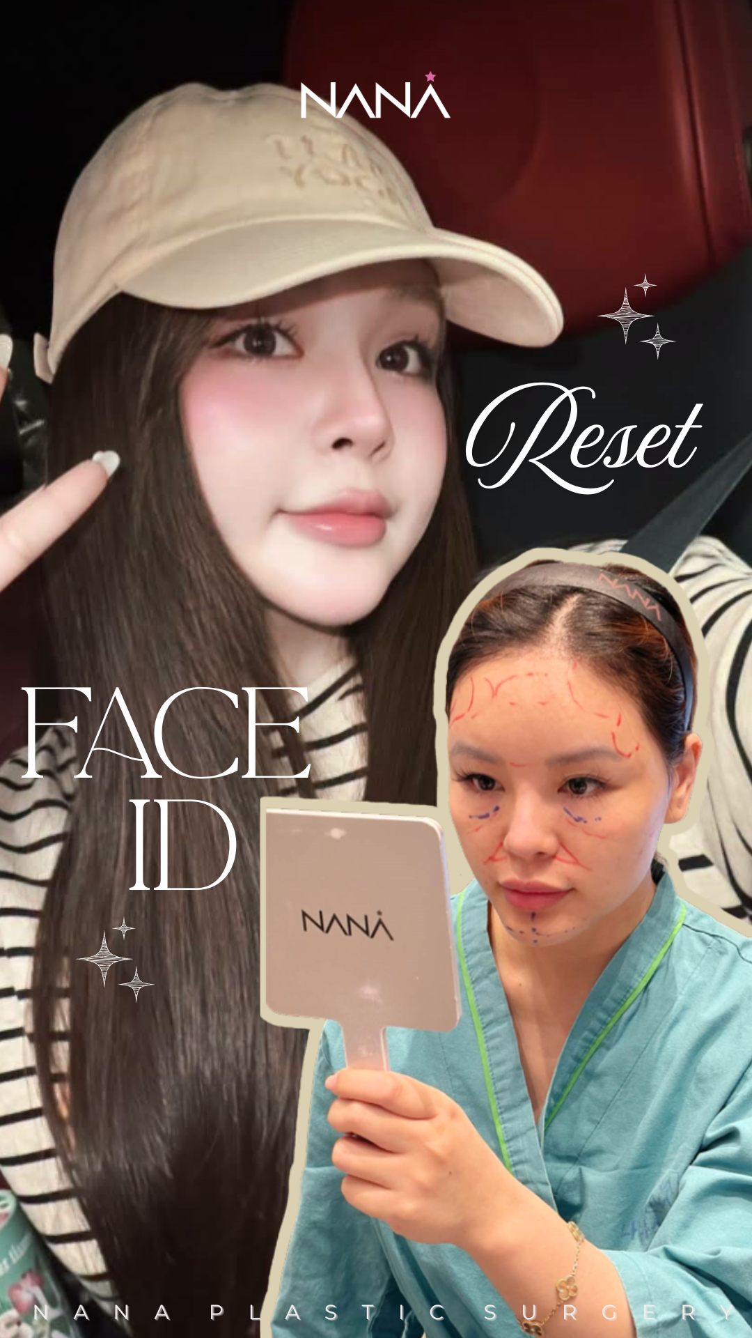 NANA Clinic Instagram Reel 6
